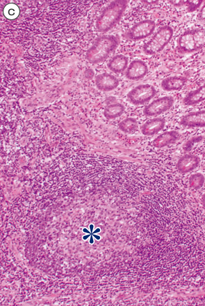 正常粘膜におけるリンパ濾胞c