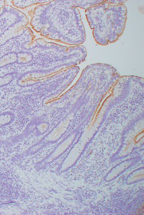 正常粘膜におけるリンパ濾胞d