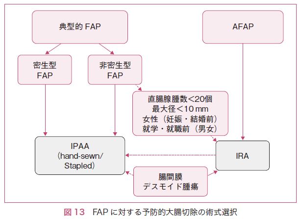 図13　FAPに対する予防的大腸切除の術式選択