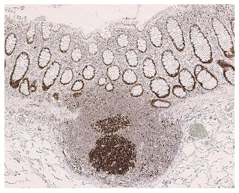 図25　非腫瘍粘膜におけるMSH2染色例