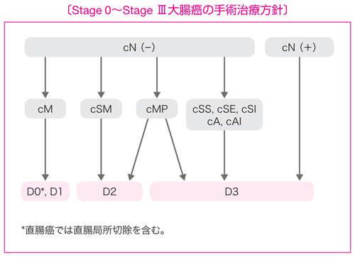 Stage0～StageⅢ大腸癌の施術治療方針