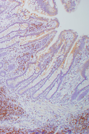 正常粘膜におけるリンパ濾胞g