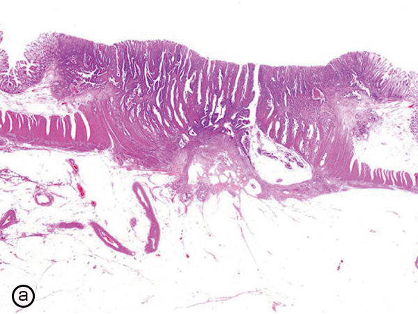 原因と危険因子